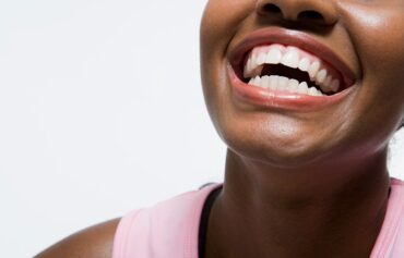 Teeth Whitening