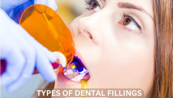 Exploring the Different Types of Dental Fillings