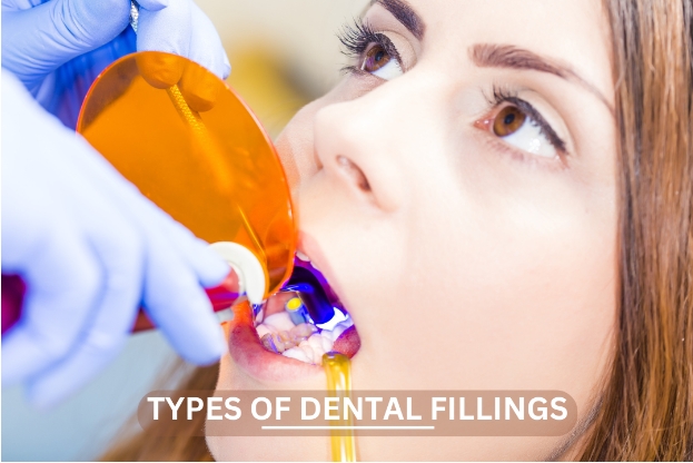 Exploring the Different Types of Dental Fillings