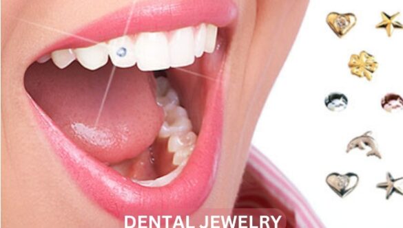 Understanding the Cost of Dental Jewelry