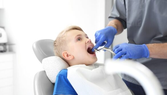 Why You Might Need a Tooth Extraction