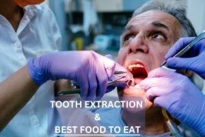 Best Foods to Eat After a Tooth Extraction: Discovering the Foods to Eat After Extraction